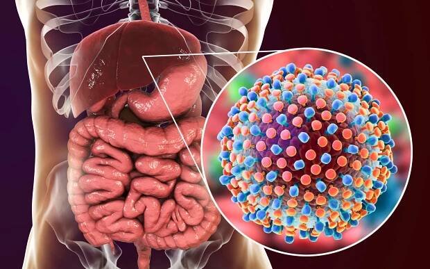Hepatitis C - medsave clinic