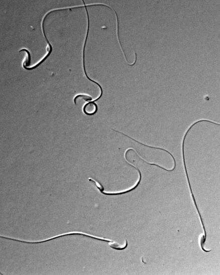 Bewertung der Spermatogenese und Spermaqualität - Leibniz-Institut für Zoo- und Wildtierforschung
