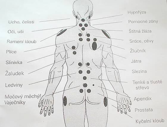 Baňkování | Masáže Brno, Wellness 2000