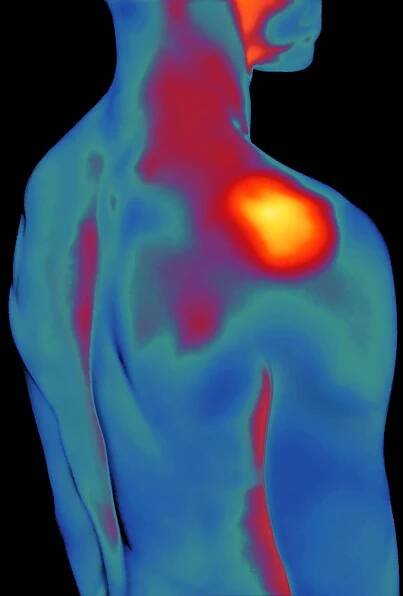 A thermal image of the body from the neck to the waste. The area around the shoulder joint is red and orange, while the other parts of the body or blue.