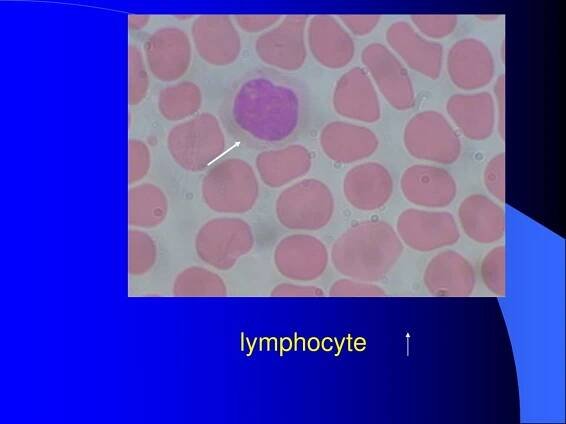 PPT - Connective tissue 2 PowerPoint Presentation, free download - ID:214368
