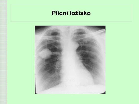 PPT - Srdce, plíce PowerPoint Presentation, free download - ID:3551924
