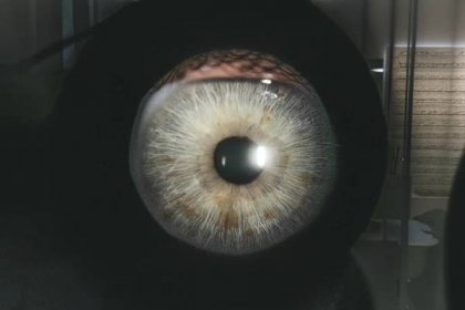 Optika Richter | Glaukom může způsobit oslepnutí – využijte preventivní prohlídku zdarma!