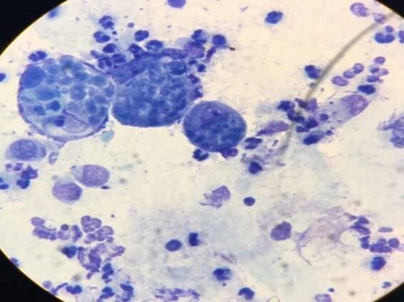 Chlamydiaceae