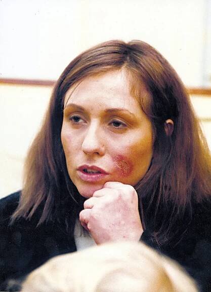V té době se tam léčila Pergnerová
