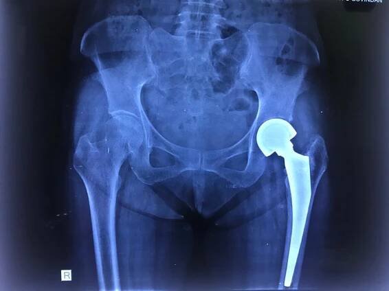 best orthopaedics surgeon kochi | Dr. Nijith O Govindan