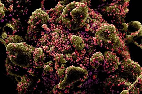 COVID Research Funding to Be Slashed, NIH Documents Show