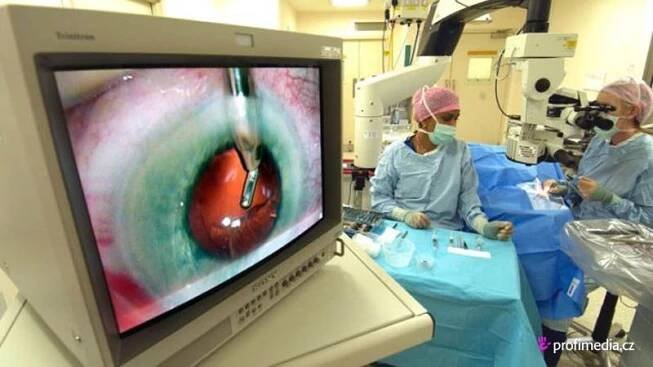Laserová operace zdaleka neodstraní všechny oční vady