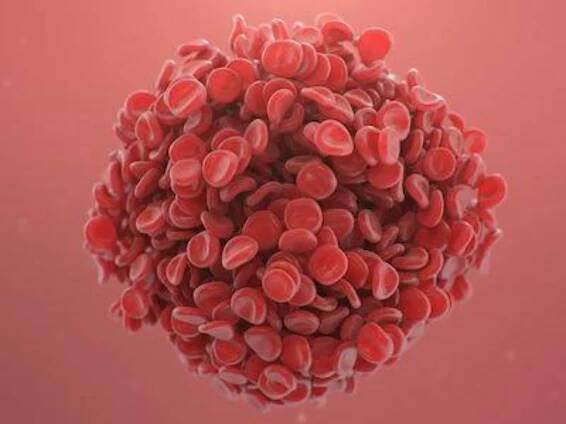 Treatment Algorithm in Cancer-Associated Thrombosis: Updated Canadian Expert Consensus Related RAM: Khorana RAM