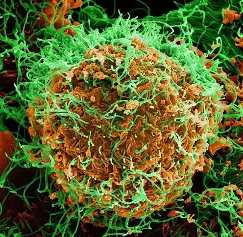 Ebolavirus - Wikipedia
