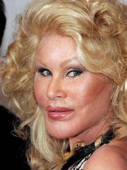 Jocelyn Wildenstein