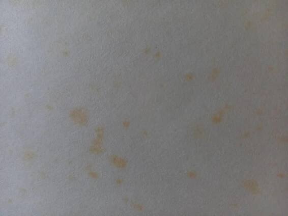 Žluté skvrny na textilu, a papíru