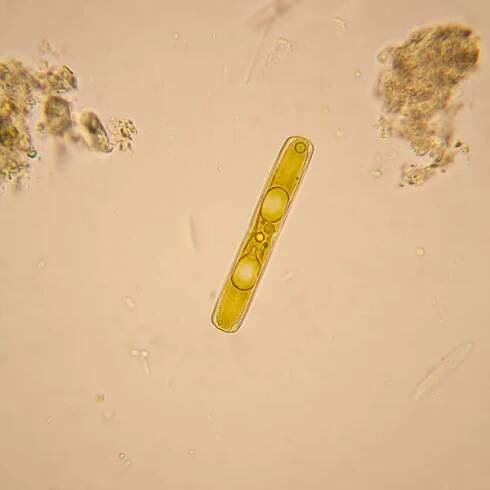 Čerstvé rybníka vodní plankton a řasy u mikroskopu. Rozsivek — Stock obrázek