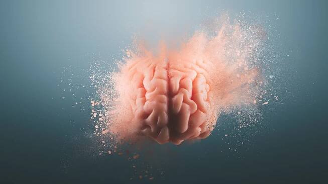 Is 'brain rot' real? Experts weigh on on the impact of excessive screen time on our brains
