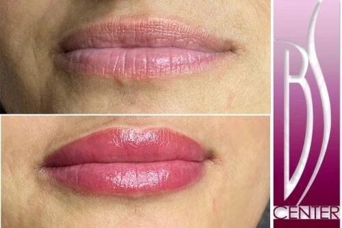 Permanentní 3D make-up rtů