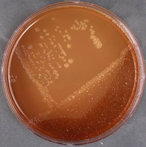 Corynebacterium diphtheriae subsp. diphtheriae C7s, C7 s (-) tox- | Type strain | DSM 44123, ATCC 27010, CIP 100721, NCTC
