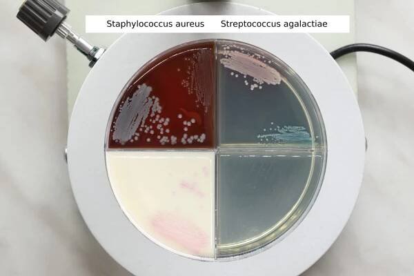 Staphylococcus aureus