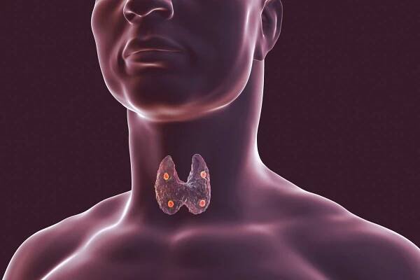 25 Facts About Nephropathy Deafness Hyperparathyroidism 