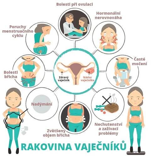 Rakovina vaječníků se často zjistí pozdě. Je těžké ji poznat a screening neexistuje