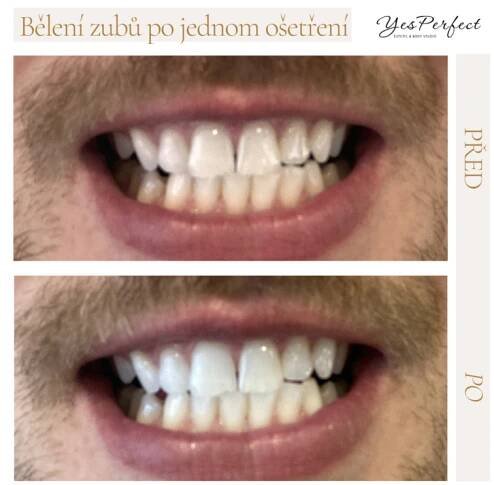 Before and After Instagram Post(3)