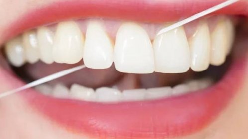 Paradentóza dokáže člověka připravit o zuby. Příznakem je krvácení dásní i zápach z úst