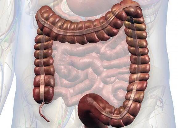 Image of intestines with appendix