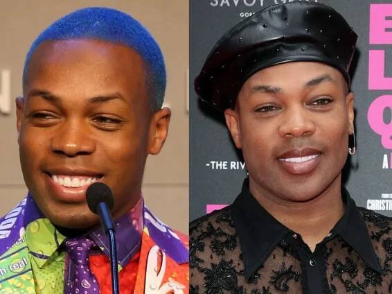 Todrick Hall’s Teeth Before and After