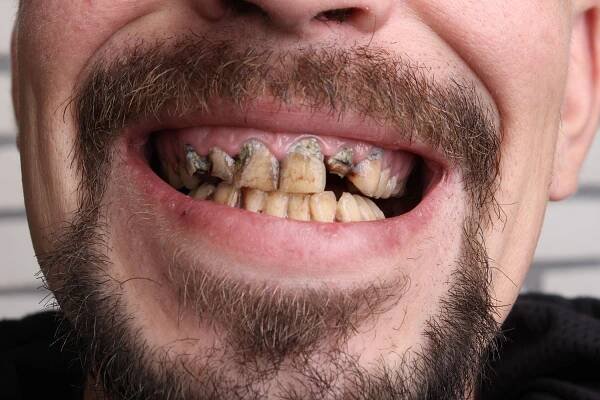 Tracking Firearm Violence and Impact on Dental Health