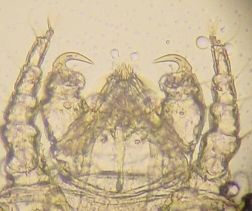 Gnathosoma – Wikipedia
