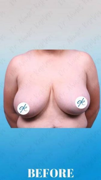 Plastic Surgery Gallery – Merientis