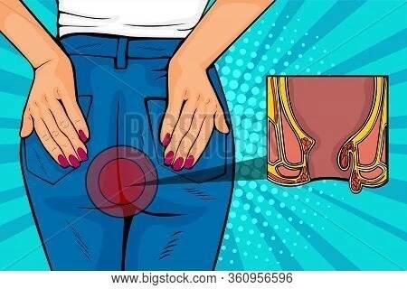 Pop Art Retro Comic Style Vector Illustration Of Human Body With Hemorrhoids
