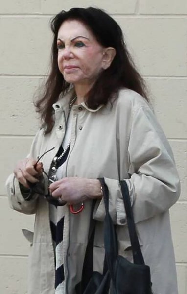 Jackie Stallone (92), i takhle to může dopadnout, když to přeženete s plastikami - Obrázek 5