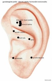 Gynekologických potíže - body na uchu