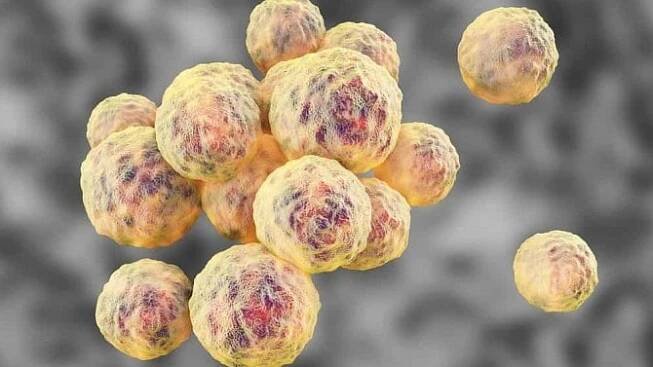 Zlatý stafylokok a MRSA: přenos, příznaky a léčba - Zdraví.euro.cz