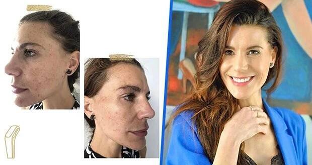 »Potvora« ze Slunečné Monika Timková: Tohle je její tvář bez make-upu! Akné a pigmentové skvrny