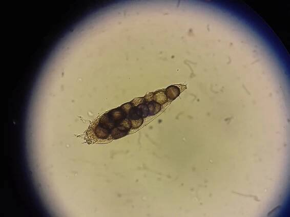 demodex parazit pod kůží u psa nebo lidé fotografují z mikroskopu - svrab - stock snímky, obrázky a fotky