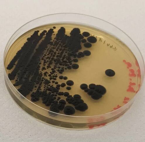 Corynebacterium pseudotuberculosis a Mycobacterium avium subspecies paratuberculosis v mléce a mléčných produktech ovcí a koz