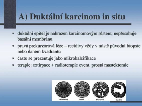 PPT - Senologie - nemoci prsu PowerPoint Presentation, free download ...