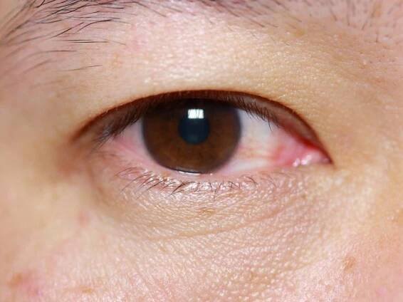 A close-up shot of a human eye