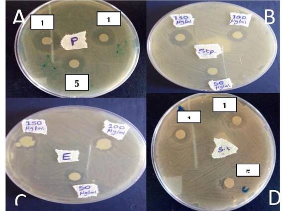 Antibacterial activities of the synthesized AgNPs at 50-150 ug/ml concentrations are shown in Fig. 6. The particles demonstrated remarkable antibacterial effects against the clinical bacterial strains of  mm for biosynthesized AgNPs using leaf strains. Though, the exact mechanism of  P  aerugin osa, S. aureus, S. Typhi and E. coli by inducing 10-20 nm zone of inhibi test organ sms (Table 1). These results corroborate the antibacterial activities of AgNPs reported in the previous studies (Priyadarshini et al., 2013; Shankar et al., 2014; Salem et al., 2014; Augustine et al., 2014; Lateef et al., 2015a, b; 2016d). For instance, most recently Lateef reported that the cocoa pod husk extract-mediated AgNPs induced zone of inhibition of 10-14 mm against clinical isolates of bacteria while Sale  et al. (2016a  m et al. (2014) reported zones of inhibition of 7-19 atex of Ficus sycomorus against some bacteri ity of AgNPs is not yet  isms. For instance, the a  and ibacte researchers have suggested many possible eff  rial acti known but  ntibacteri  activity of AgNPs was assumed to be relat size, the larger the surface area to volume ratio.  microbial cells. Similarly, Pal et al. (2007)  also shape dependent. AgNPs attack bacterial cel which induce antibacterial effects like denaturati replication and respiratory chain finally leading to death (Fe Sondi, 2004; Morones et al., 2005; Song et al., 2006).  nes et al., 2005), the smaller t facilitates the interaction wi ntibacterial activity of AgNPs i  he release of silver ions  Ne dl  through in the ce  tion against the  a  a  he th  is Is  on of cell membrane, interference with DN  ., 2000; Sondi and Salopek-  ng et  A  Fig. 6: Antibacterial activities of the synthesized AgNPs (150, 100, 50 g/ml) against clinical bacterial isolates (A, Pseudomonas aeruginosa; B, Staphylococcus aureus; C, E. coli; D, Salmonella Typhi). 