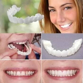 Licovací sada Snap on Smile 1 sz (nahoře a dole)