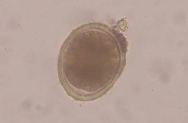 Toxocaridae – Wikipedie