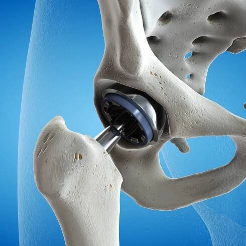 Services – Parmele Post Rehab Exercise and Massage