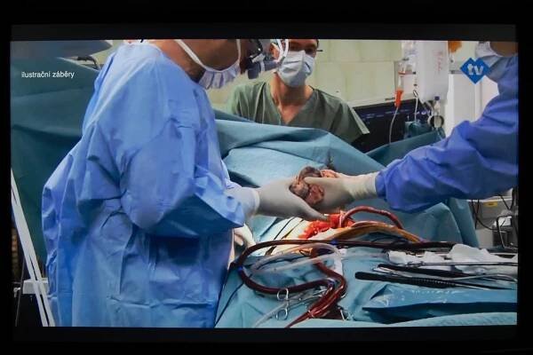 Bez vakcíny na transplantaci zapomeň: Klinika v USA odmítá neočkované pacienty i dárce orgánů