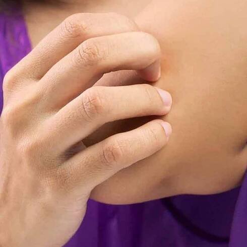 Cura della psoriasi