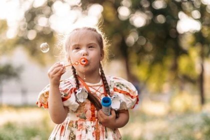 Dívka s Downovým syndromem fouká bubliny. Každodenní život dítěte se zdravotním postižením. Chromozomální genetická porucha u dítěte. — Stock obrázek