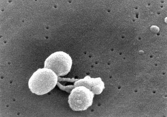 Gram pozitivní, streptococcus pneumoniae, bakterie