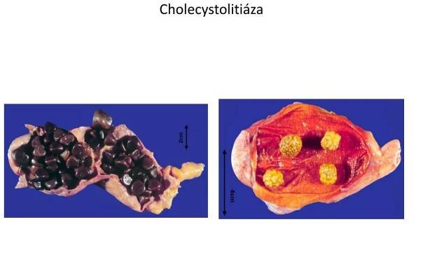 PPT - PORUCHY METABOLISMU MINERÁLŮ PowerPoint Presentation, free download - ID:1861576