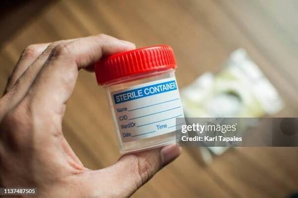 plastic urine collector and sterile bottle - medical sample stock pictures, royalty-free photos & images