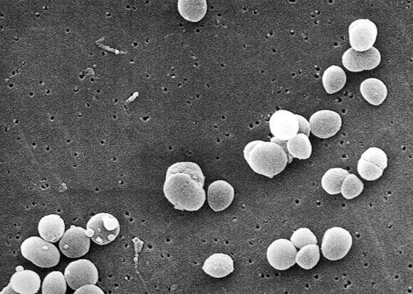pozitivní, staphylococcus aureus, bakterie